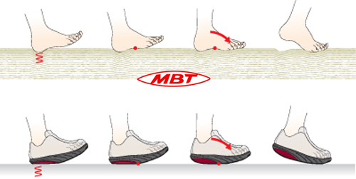 Tehnologija obutve MBT